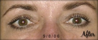 patch anti age lifewave