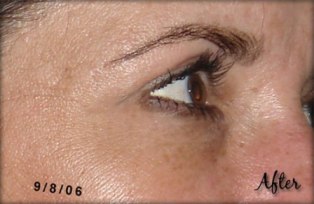patch anti age lifewave
