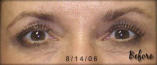 patch anti age lifewave