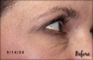 patch anti-age lifewave